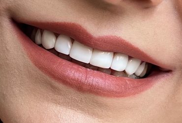 6457C2A7-9888-4929-B88F-B058F33D0AD0