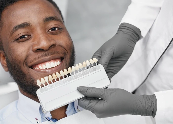 دوام کامپوزیتها