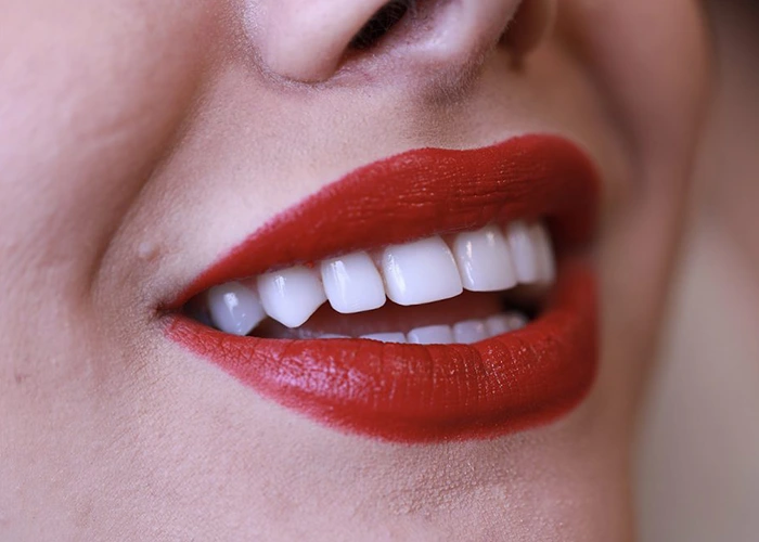 کامپوزیت دندان چیست و چگونه عمل میکند؟