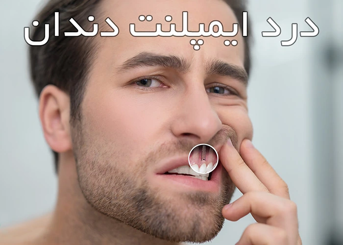 نکات مهم برای کاهش درد بعد از ایمپلنت