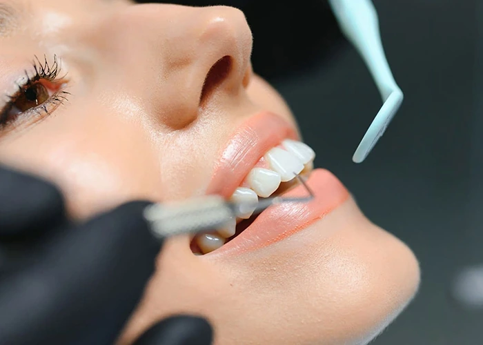 جدول مقایسه مزایا و معایب کامپوزیت دندان