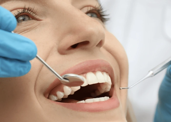 علائم پوسیدگی دندان زیر کامپوزیت چیست؟