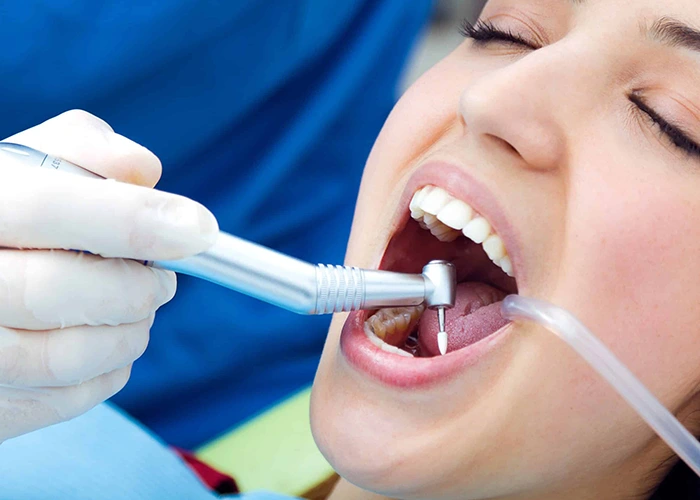 کامپوزیت دندان چیست و چه کاربردهایی دارد؟